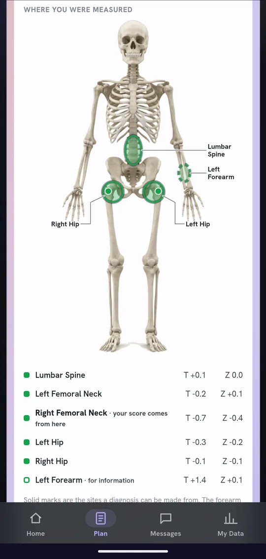 Bone density results beside a skeleton diagram showing where each site was measured